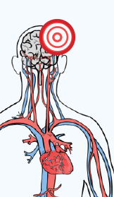 Color drawing of the cardiovascular system, chest up. There is a red bullseye on the upper left of the brain.