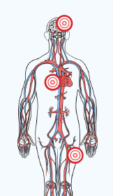 Color drawing of the cardiovascular system, knee up. There are red bullseyes on the brain, heart and hip.